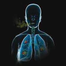 LE RADON : LES FUMEURS PLUS À RISQUE QUE LES NON-FUMEURS